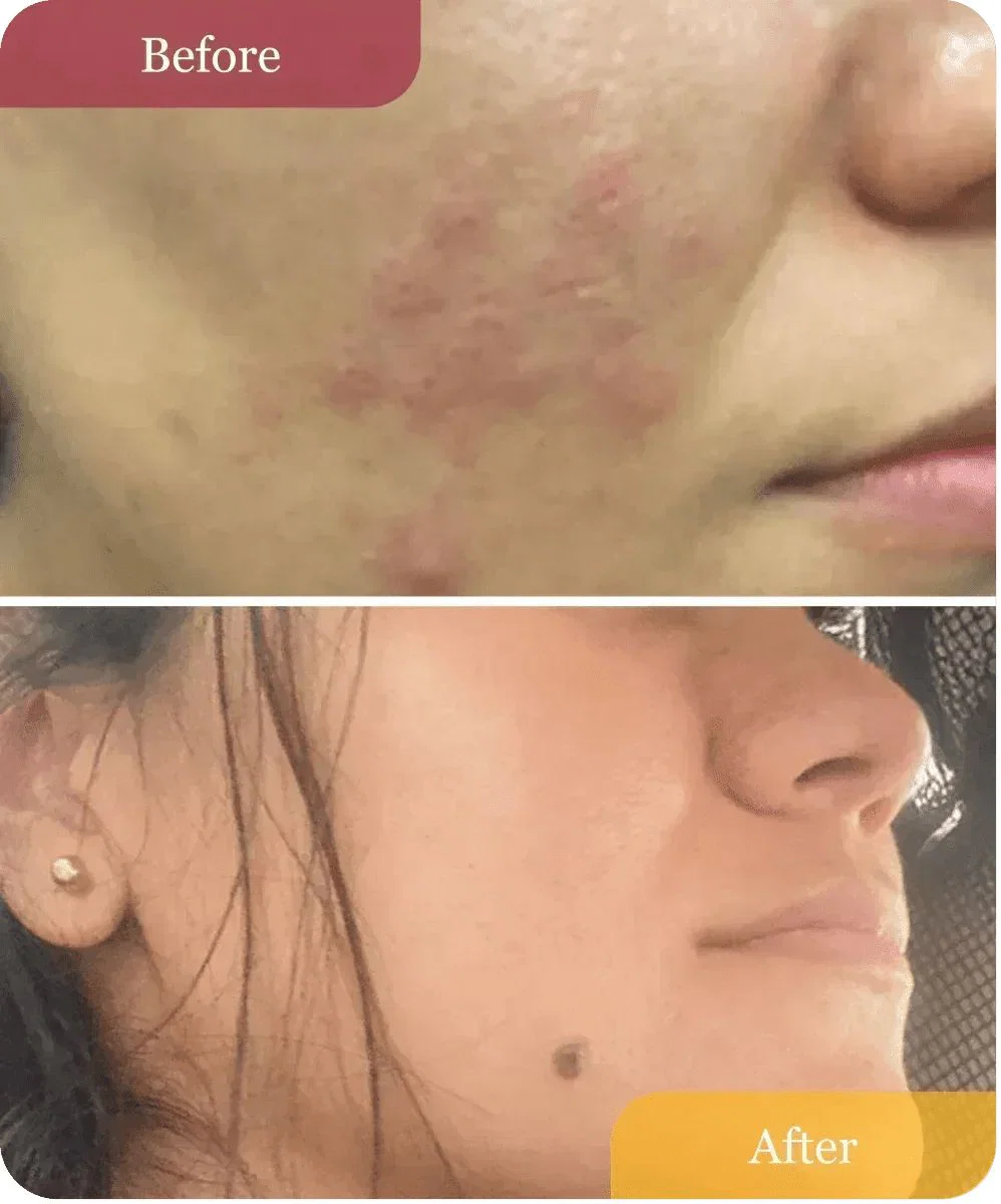 CLEAR + CALM DUO - Image 3