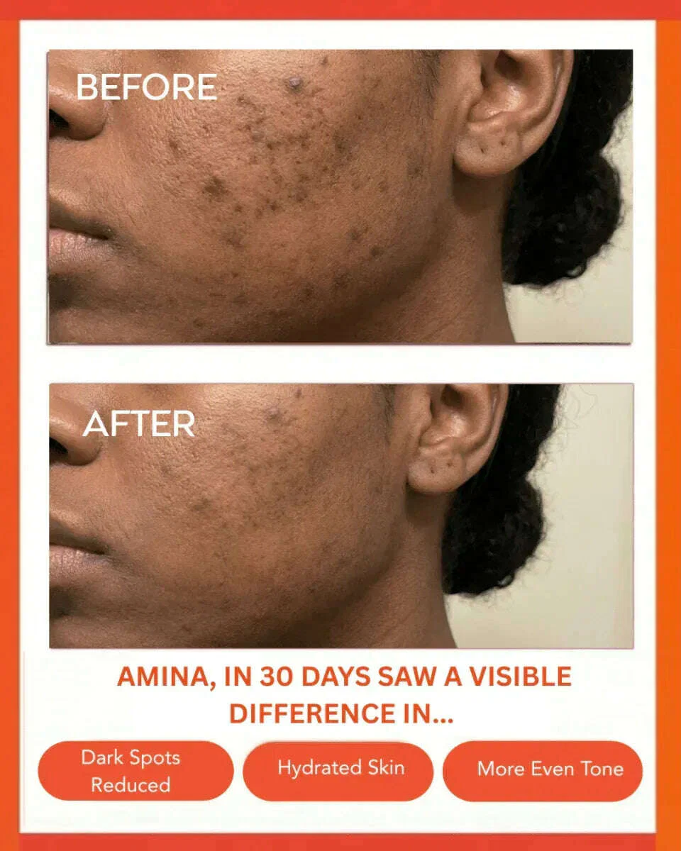 Clear Confidence Moisturizer - Refillable - Image 4