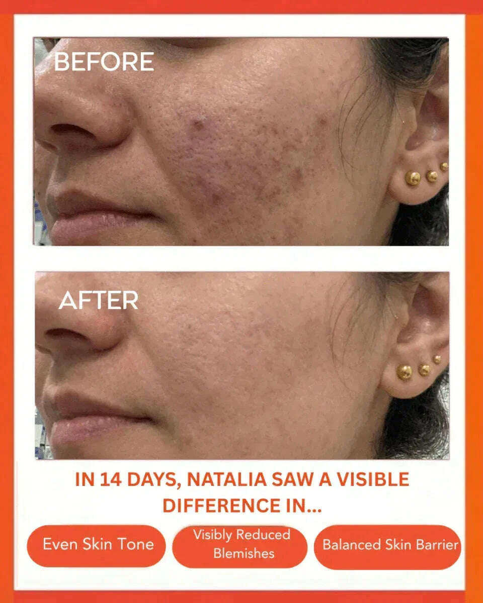 Clear Confidence Moisturizer - Refillable - Image 5