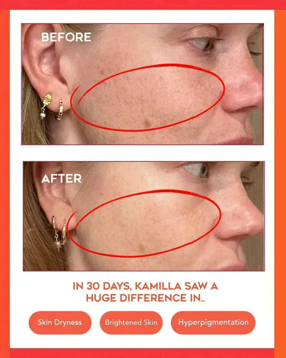 Hydrating Dew Moisturizer - Refillable - Image 10