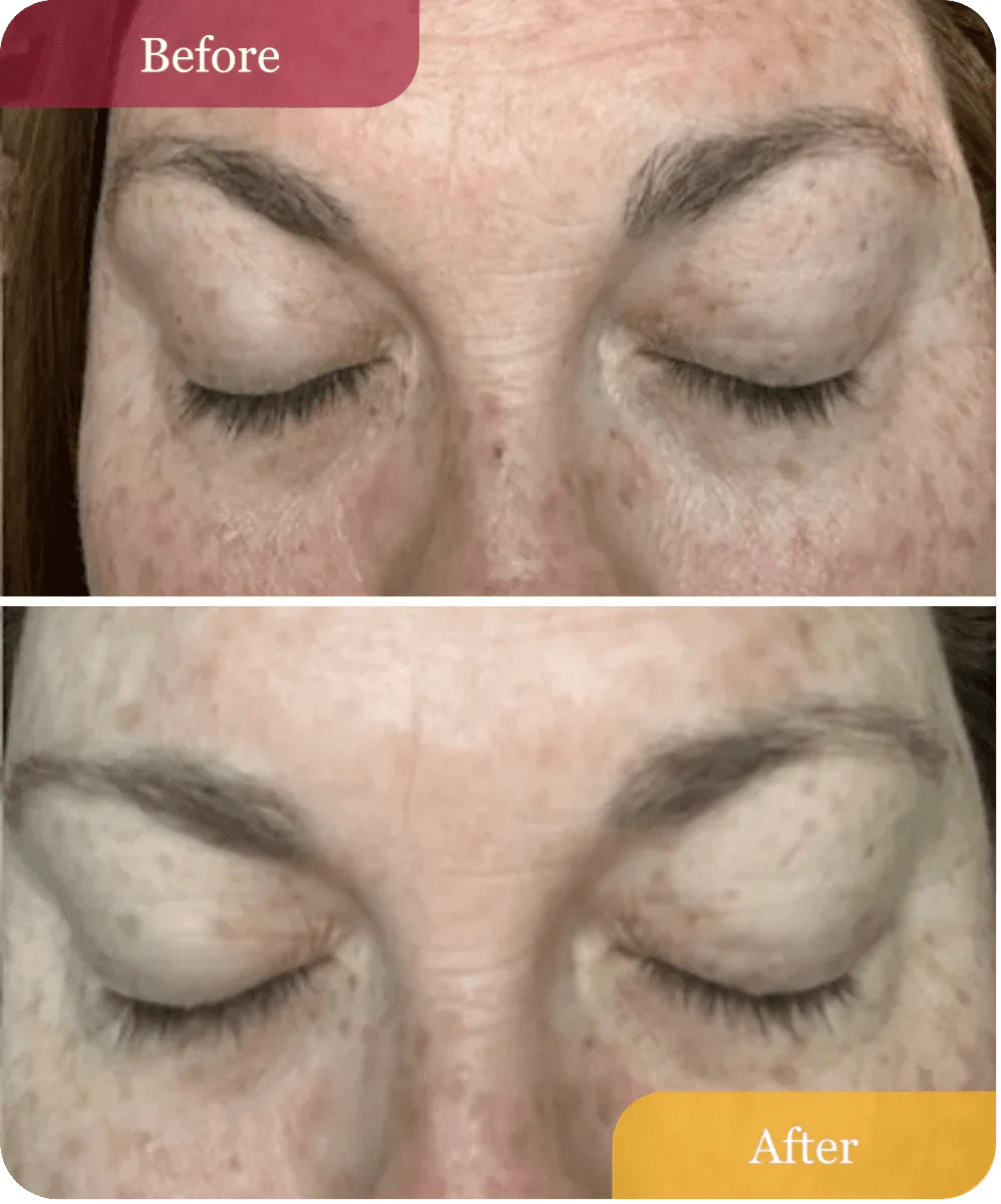 Hydrating Dew Moisturizer - Refillable - Image 9